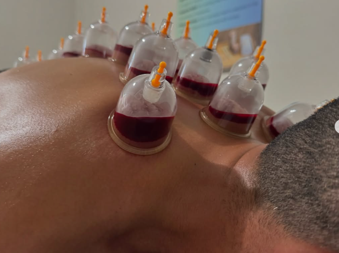 Alchemist Academy – Certified Hijama Practitioner Course Sydney (October Intake)
